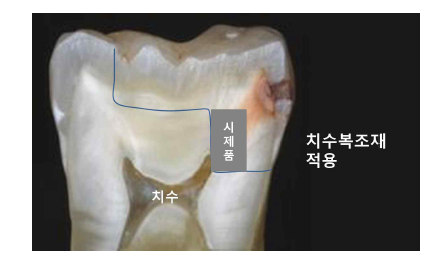 시제품의 적용.