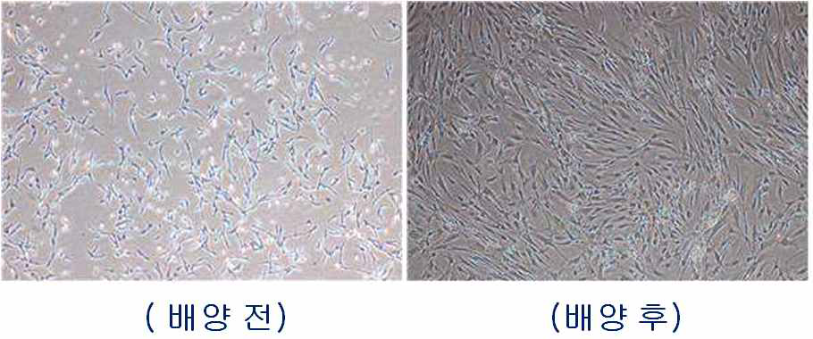 성장인자와 아미노산을 이용한 섬유아세포에서의 세포 증식능 비교