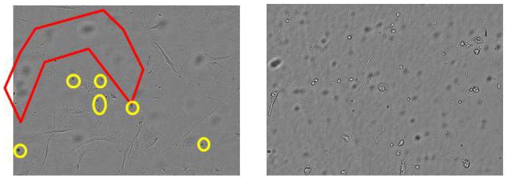 hUCB-MSC 줄기세포 이미지 (좌)와 HeLa 세포 이미지 (우)의 배경 문제점