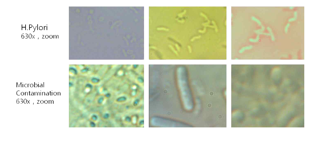 H.Pylori 현미경 사진