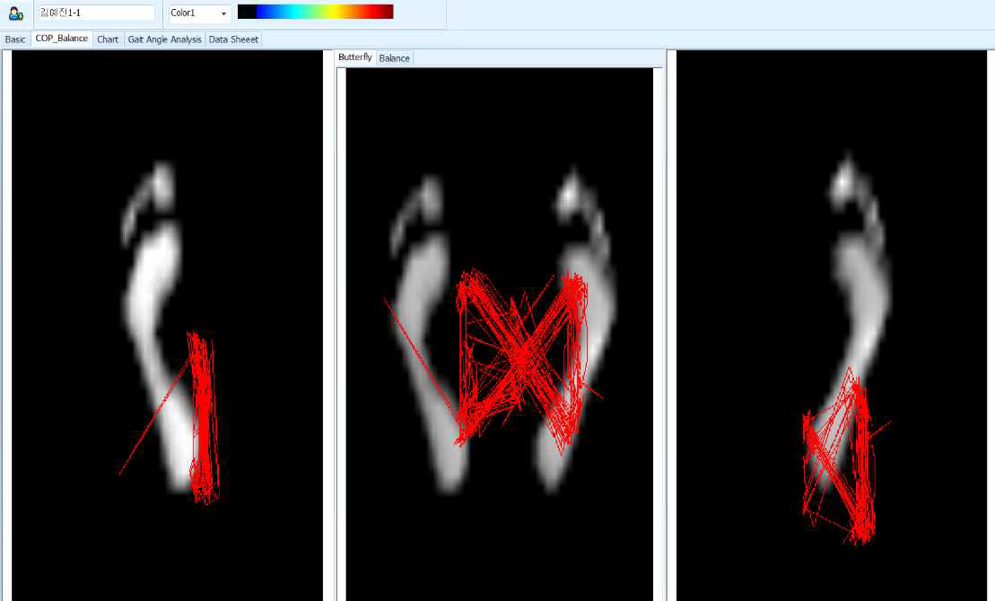 보행측정 데이터(butter fly chart)