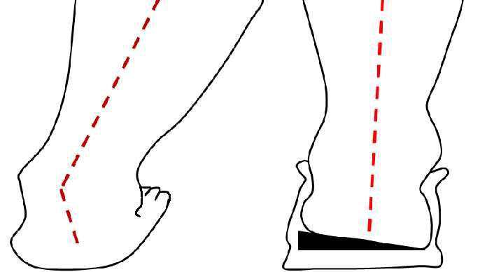 플랫폼 각도 적용 족골격 형태