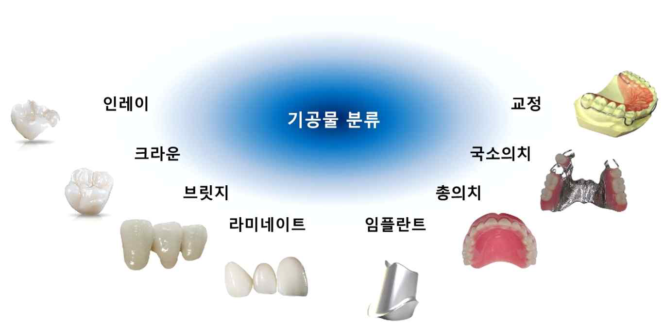 선정된 보철물(기공물) 분류