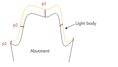 절단 된 측정 부위(p1:변연, p2:축벽, p3:교합면)