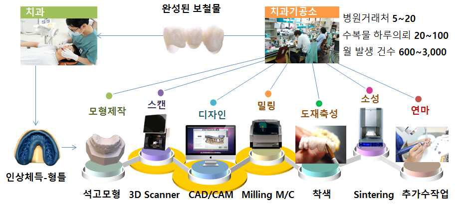 치과기공소 생산 공정 현황