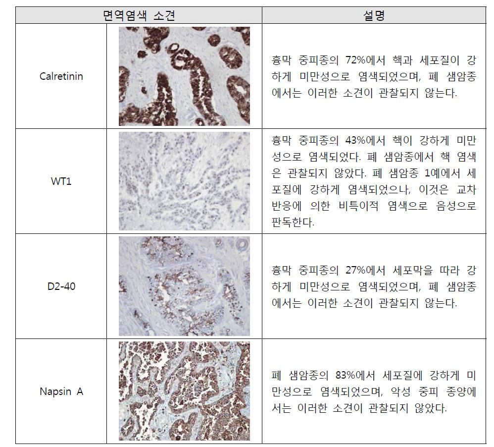 중피종에서 Calretinin, WT1, D2-40, Napsin A에 대한 면역염색 결과