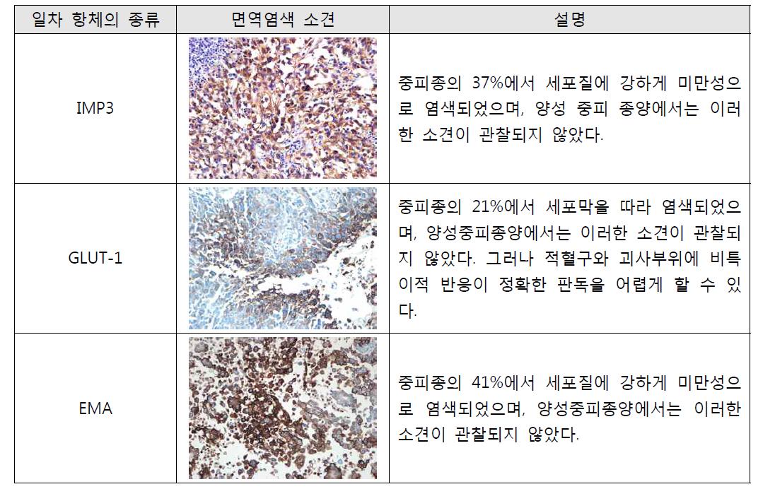 중피종에서 IMP3, GLUT-1, EMA에 대한 면역조직화학염색 결과