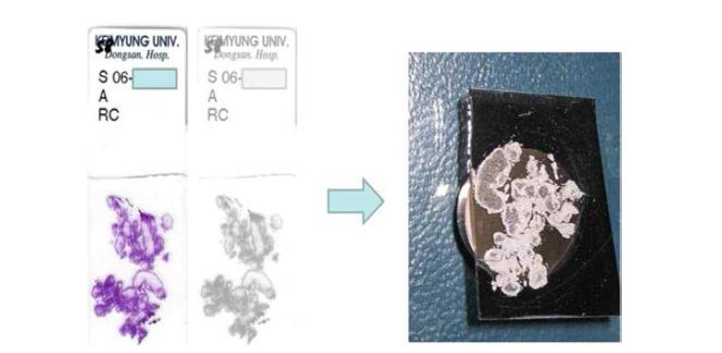 파라핀 조직을 추가로 세절하여 주사전자현미경용 관찰대에 올림