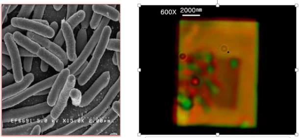 나노 hole 칩 상에 분포한 E-Coli 세포 전자주사현미경 사진(왼쪽), 오른쪽 현미경