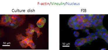 각 표면위의 MCF-7세포의 세포 골격 및 흡착 면역형광염색