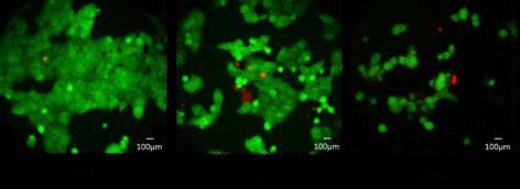 약물 처리 농도에 따른 세포의 live(녹색)와 dead(적색) 확인