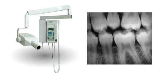 치과용 X-ray 기기와 촬영된 치아 영상