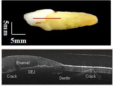광프로브로 구현한 치아의 이미지