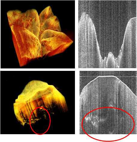 고분해능 광단층영상시스템으로 얻은 치아의 이미지