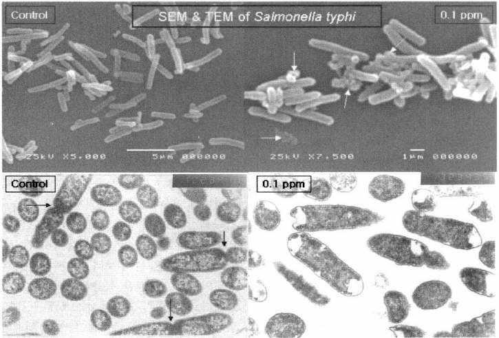 Salmonella typhi의 SEM과 TEM사진