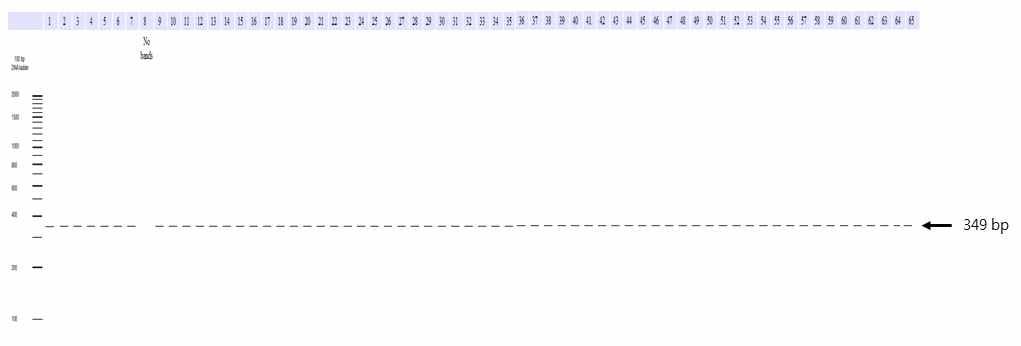 In-silico PCR을 통한 대장균에서의 β-glucuronidase 유전자의 검출