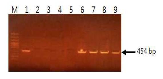 9종의 표준균주를 대상으로 한 β-galactosidase의 PCR 검출.