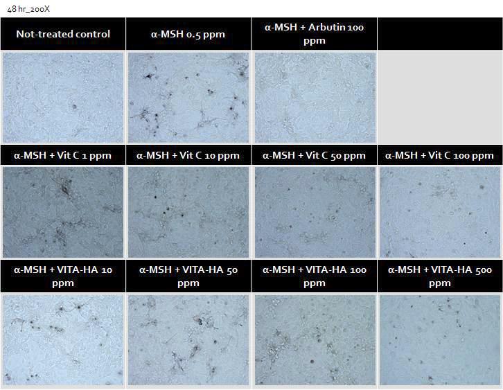 Ascorbic propyl hyaluronate의 처리에 의한, 멜라닌 형성세포의 양상 변화