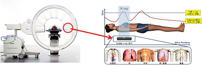 차세대 입체영상진단용 고성능 high-frame rate X-ray 센서 C-arm system 적용 예