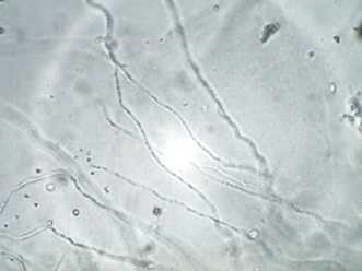 불용성 인산염을 분해하는 S44 균주의 현미경 사진(×1,000)
