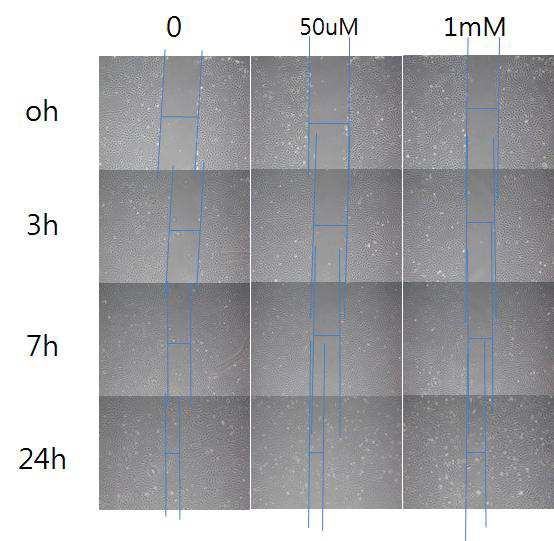 Huvec에 대한 migration assay 결과