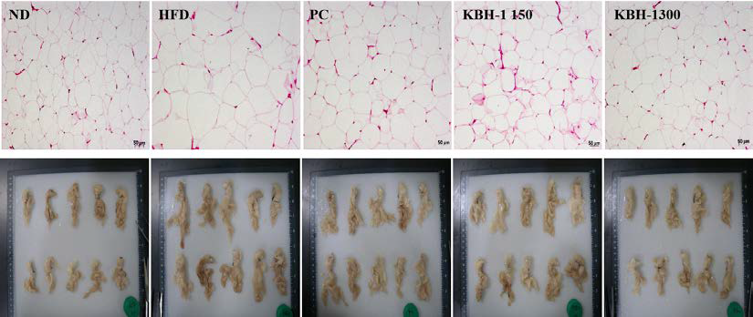 이종 동물모델에서의DIO KBH-1 복합추출물의 복부생식기 지방에 미치는 영향