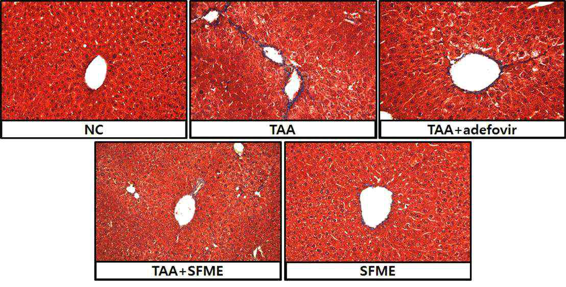 Effects of S. laceolata on collagen accumulation induced by TAA treatment.