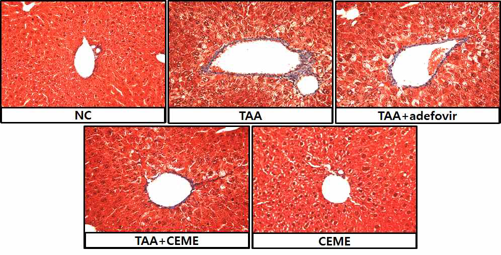 Effects of C. excavata Burm. on collagen accumulation induced by TAA treatment.