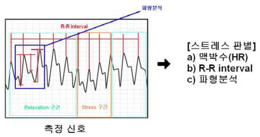 R-R interval 변화