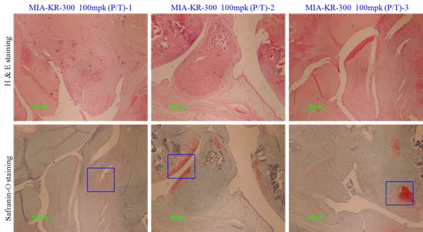 실험군(KR-300 100 mg/kg(P/T)투여군)의 관절 활막조직과 연골조직
