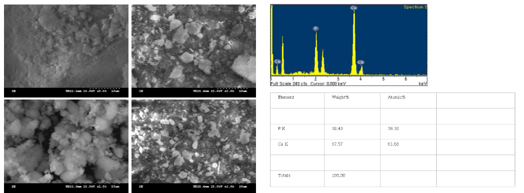 생체활성물질인 HA 입자사진과 성분분석