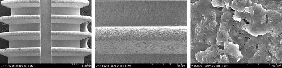 마이크로 포아를 형성한 치과임플란트 표면의 배율별 FE-SEM사진