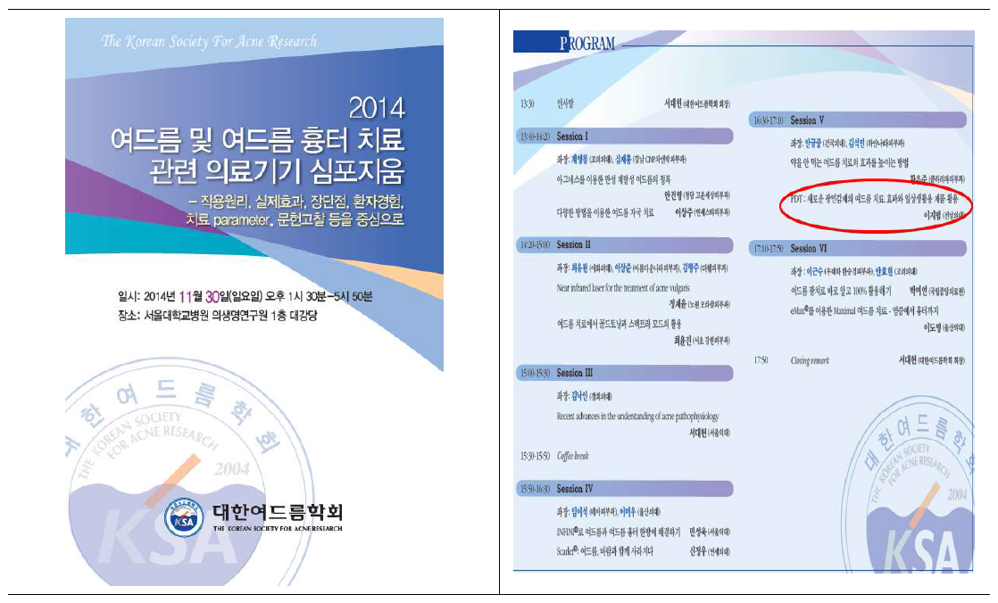 대한여드름학회 심포지움 발표