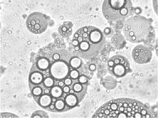 Multiple water–oil emulsion (400×, light microscopy)