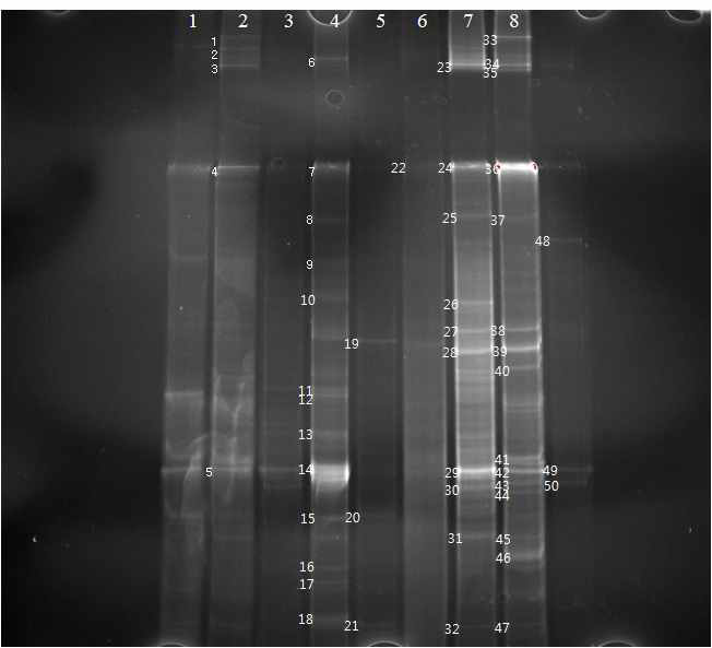 DGGE profile based on rbc gene generated from Daechung Reservoir