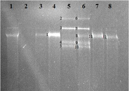 DGGE profile based on HEP gene generated from Daechung Reservoir