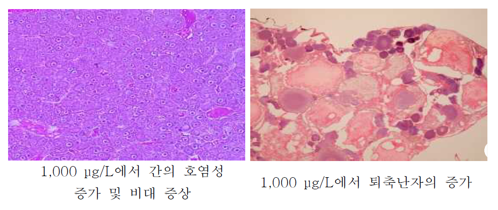 1,000 μg/L의 BPA에 노출된 피라미의 조직 변화