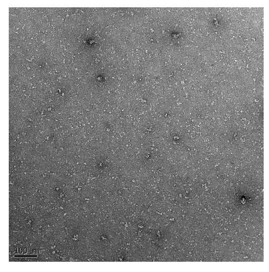 CD40-CD40L 복합체 negative staining 전자현미경 사진.