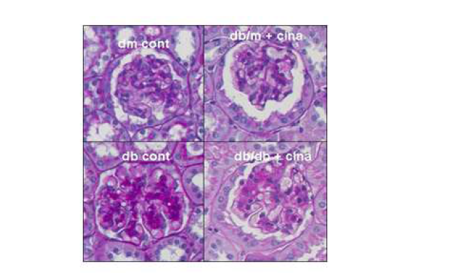 제2형 당뇨모델인 db/db 마우스에서 Cinacalcet의 사구체경화와 혈관세포간질 감소효과.