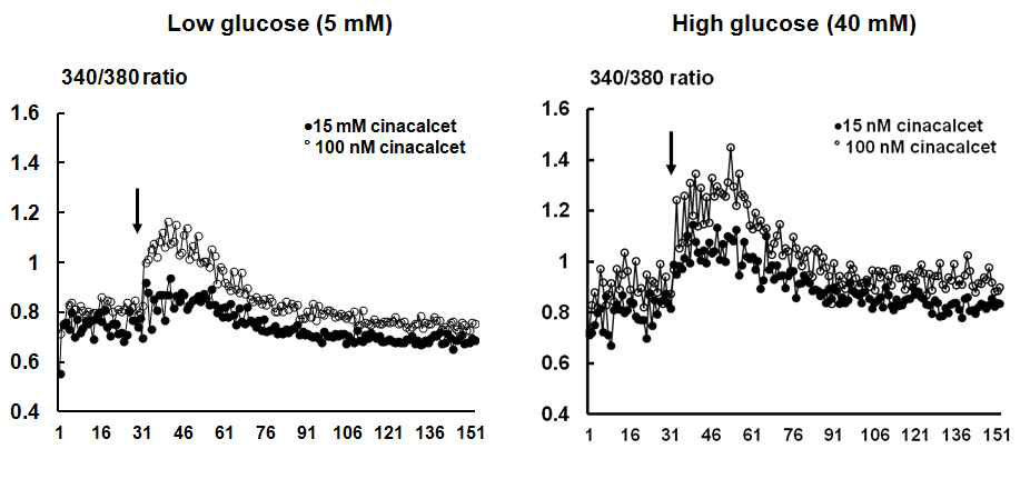 사구체 혈관내피세포에서 cinacalcet에 의한 세포내 칼슘 농도의 변화