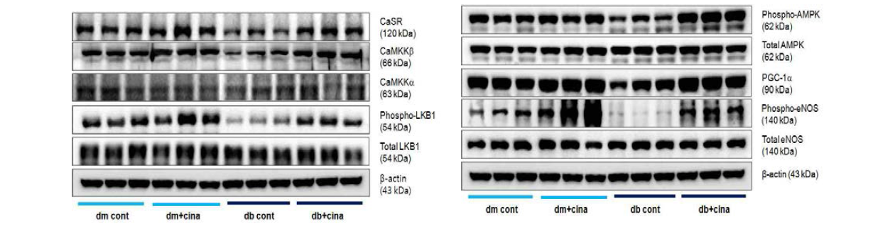 db/db 마우스의 신장에서 cinacalcet에 의한 CaMKKb-LKB1-AMPK signaling 발현 증가