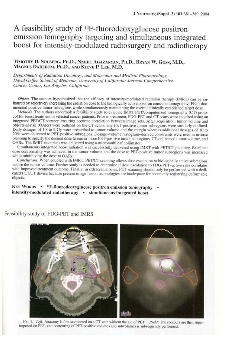 세기조절 방사선수술시 CT 과 FDG-PET영상 을 이용하여 병소에 방사선량을 추가 증강시키기 위한 치료계획을 보고한 논문.