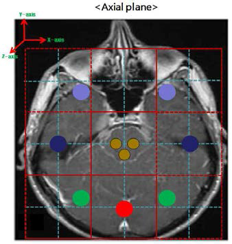 Axial plane에서 종양위치 선정