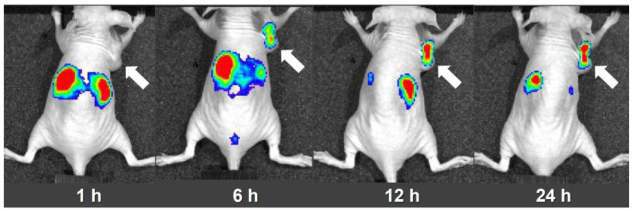 생체 내 시간의 따른 Cy5.5-ADIBO-PEG-MSNs의 종양 축적 영상.