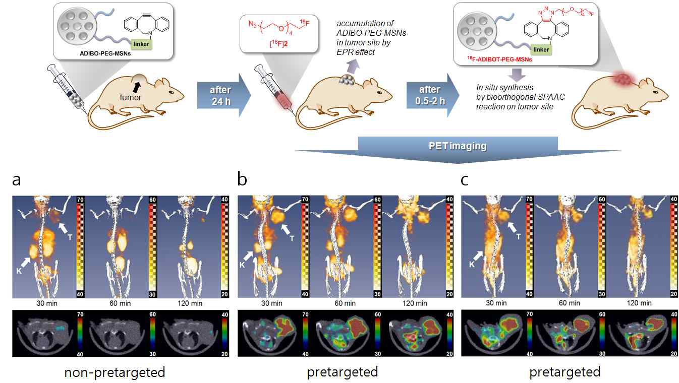 U87MG 종양 모델에 [18F]2 alone 의 PET-CT 영상 사진 (A) 와 ADIBO-PEG-MSNs (100 μg) 나노 입지를 주입 한 후 24시간 후의 [18F]2을 pretargeting PET-CT 영상 사진(B) ADIBO-PEG-MSNs (250 μg) 나노 입지를 주입 한 후 24시간 후의 [18F]2을 pretargeting PET-CT 영상 사진(C).