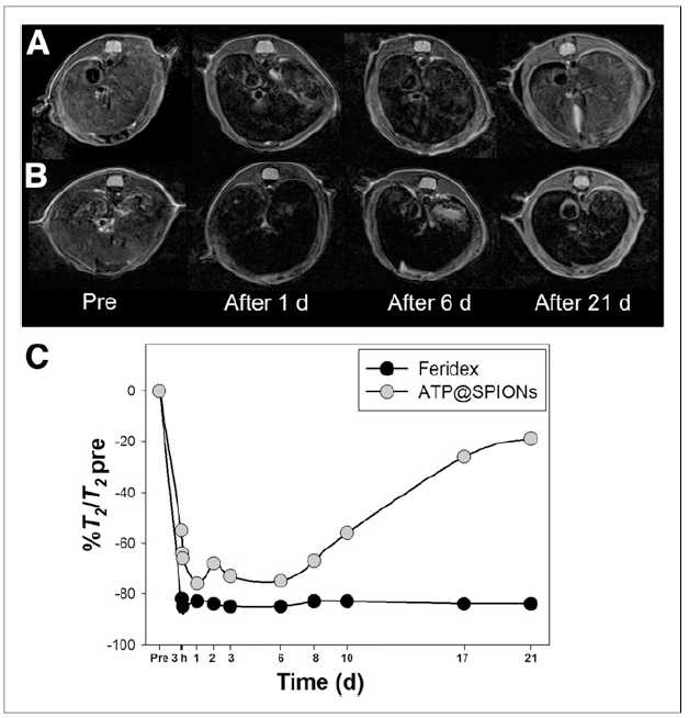 ATP 나노산화철 입자와 고분자 코팅된 산화철 입자 (Feridex)와의 체내 Degradation 비교 연구, ATP-산화철 나노입자 (A), Feridex (B), 간에서의 T2 MR signal enhancement