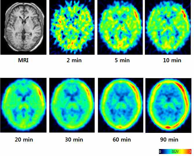 정상인에서 시간에 따른 [18F]fluoromethyl-PBR28의 뇌 분포도