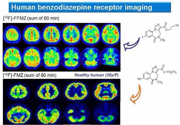 F-18 Fluoro Flumazenil([18F]FFMZ)와 18F-flumazenil 비교 영상