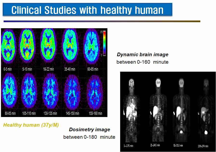 정상인에서의 6-[18F]FBTA-MA의 뇌영상 및 Dosimety study