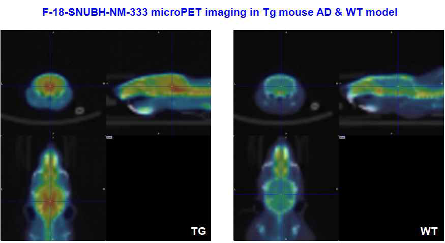 AD 동물모델과 동일 개월수 control에서의 아밀로이드 플라크 영상 비교